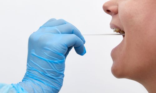 Doctor in a protective suit taking a throat and nasal swab from patient to test for possible coronavirus or covid infection